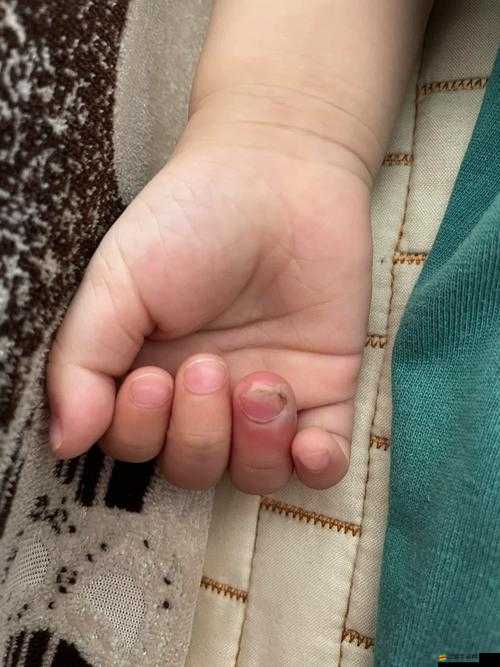 寶寶才兩根手指就哭了：究竟是為何這般脆弱