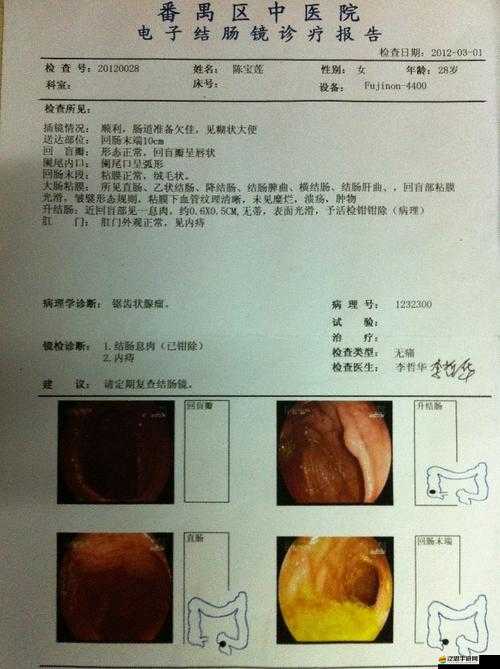 男生還沒開始就有粘液是什么：這種生理現象的詳細解析與相關探討