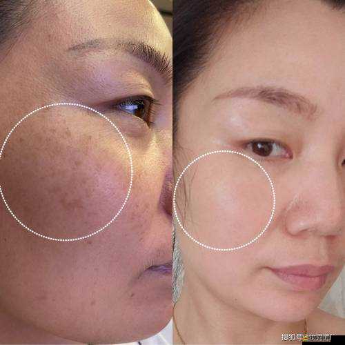 當小學生遭遇積積桶膚膚，他們如何應對？