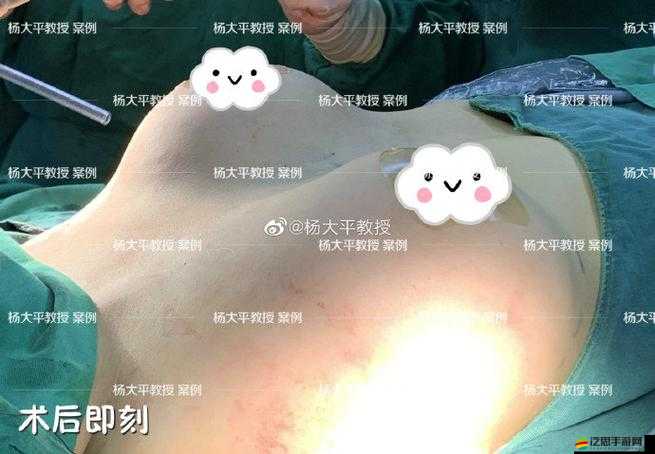 兩個奶被揉得又硬又翹怎么回事：可能的原因及應對措施